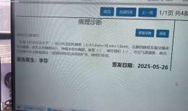 KRASQ61H突变，1A2期，后续治疗选择